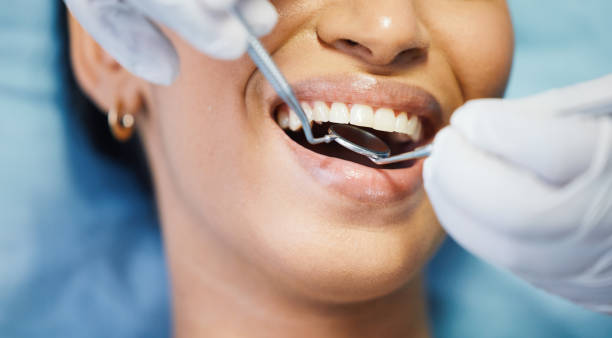 Best Broken Tooth Emergency  in Gholson, TX