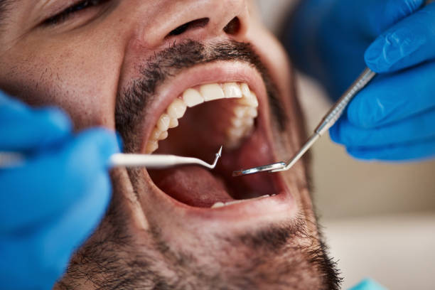 Best Cracked Tooth Emergency Dentist  in Gholson, TX